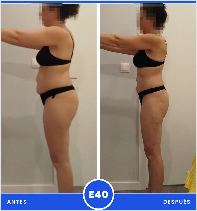 Antes y despues de una clienta del programa